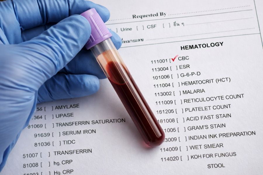 Чому результати аналізів можуть коливатись: стрес, сон, фізичні навантаження, ліки