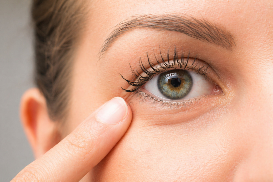 Как убрать мешки под глазами