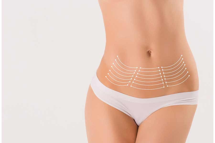 Абдоминопластика как осознанное решение Абдоминопластика