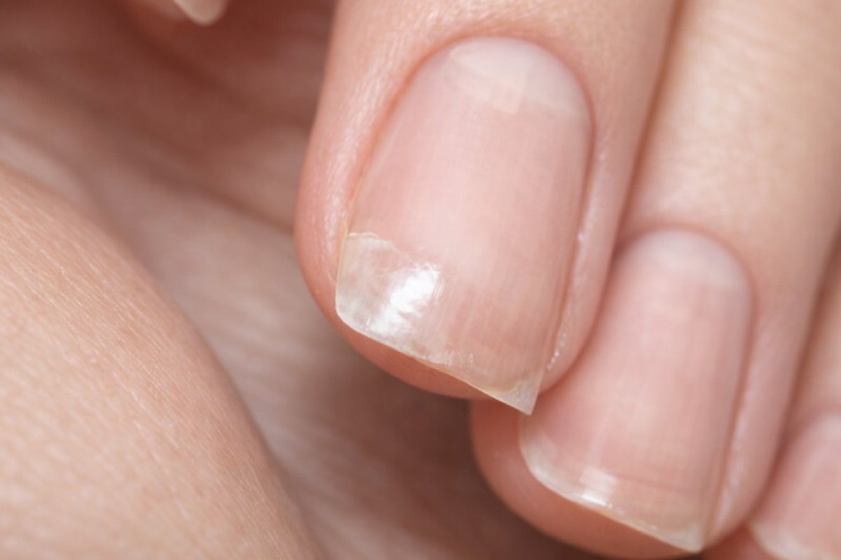 Чому ламаються нігті