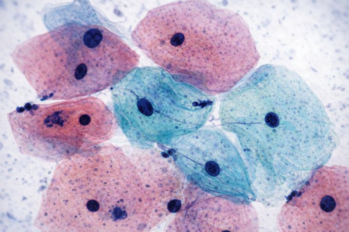 Чому ці методи працюють лише разом