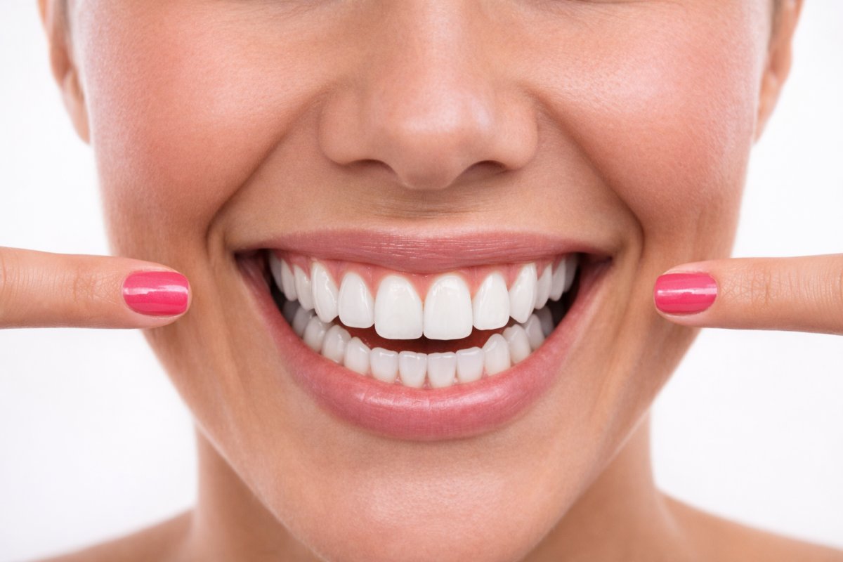 Що таке зуби мудрості