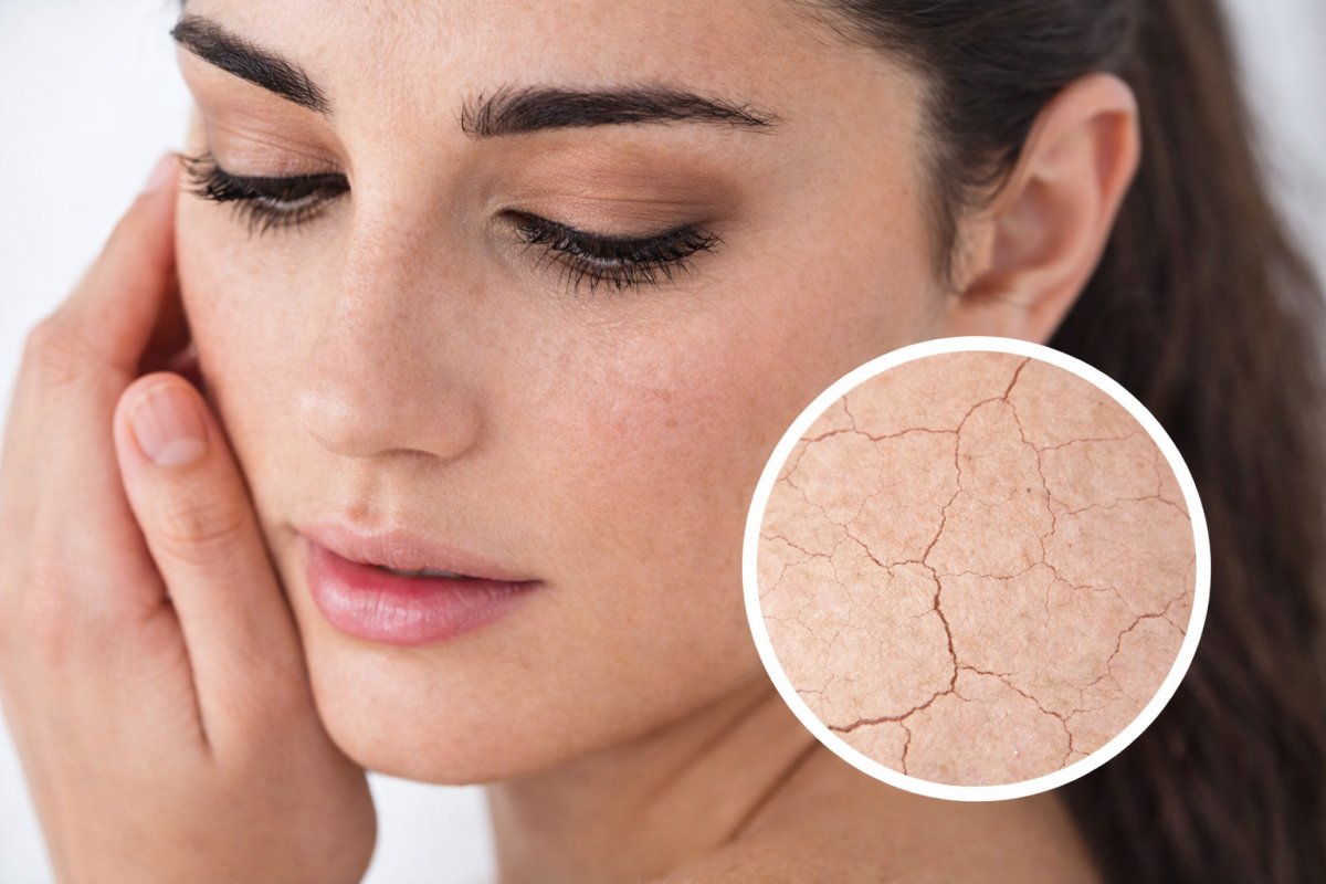 Уход за сухой кожей Уход за сухой кожей